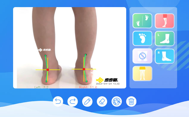 行辅助定位